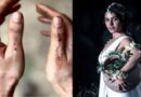 Samantha Ruth Prabhu Leaves Everyone Speechless With Her Injuries